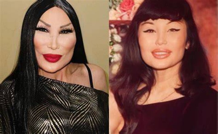 As&iacute; era Lyn May antes del tratamiento que le transform&oacute; la cara (FOTOS)