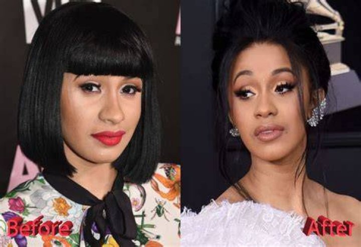 Cardi B Plastic Surgery Before And after Page 10 Bossip