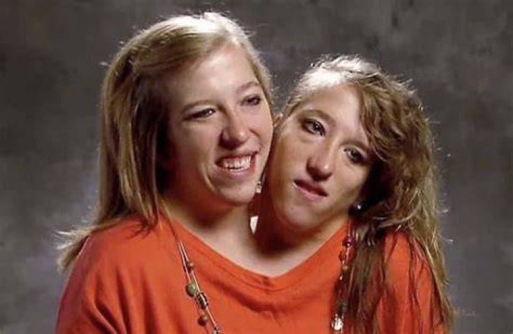 Conjoined twins Abby and Brittany Hensel face new twist in marriage to nurse Josh Bowling