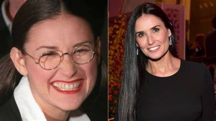 demi moore teeth transformation