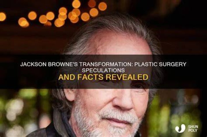 Did Jackson Browne Undergo Plastic Surgery? Did Jackson Browne Undergo Plastic Surgery?