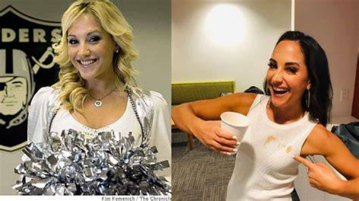 Emily Compagno Plastic Surgery Nose Job, Facelift, Boob Job, and More! Plastic Surgery Bio