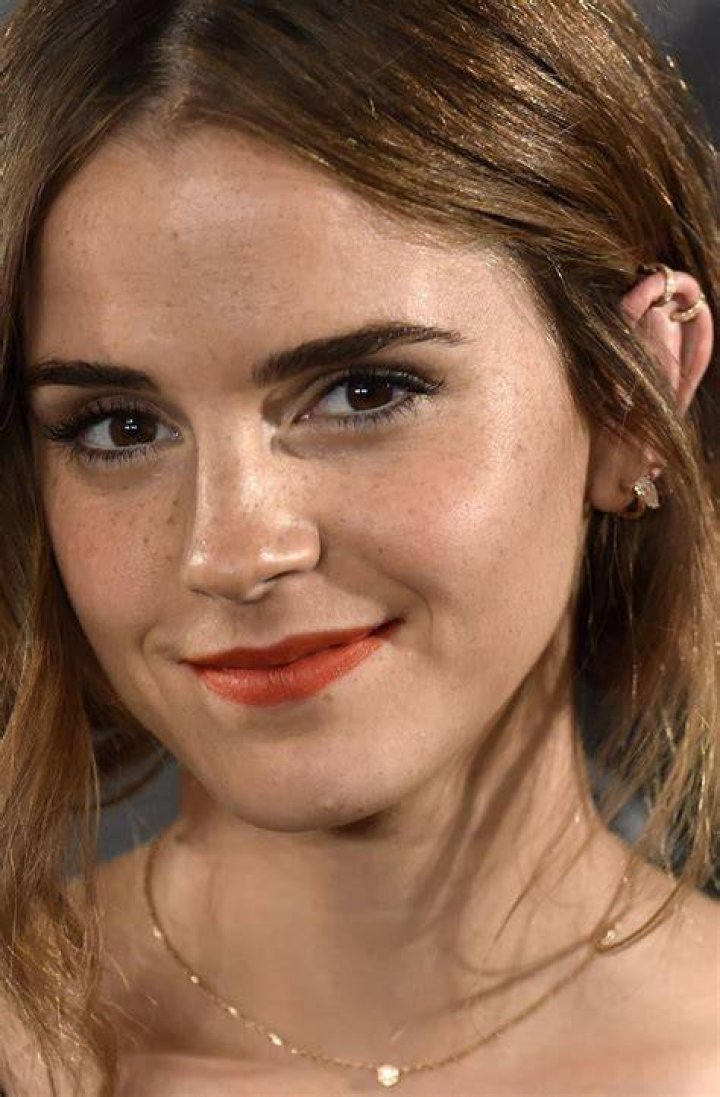 freckles emma watson