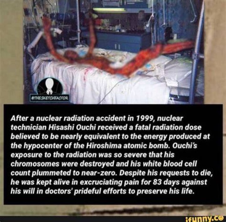 Hisashi Ouchi Suffered an 83day Death By Radiation Poisoning Flipboard