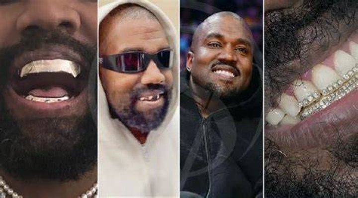 kanye west teeth transformation