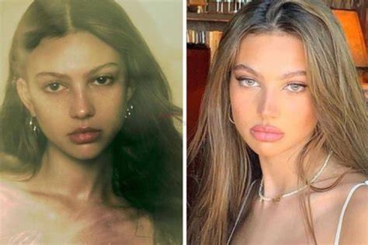 Katarina Deme Plastic Surgery Botox & Lip Fillers