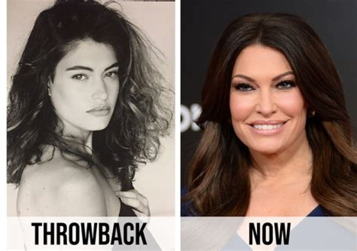 Kimberly Guilfoyle Plastic Surgery Kimberly Guilfoyle Face Before And My XXX Hot Girl