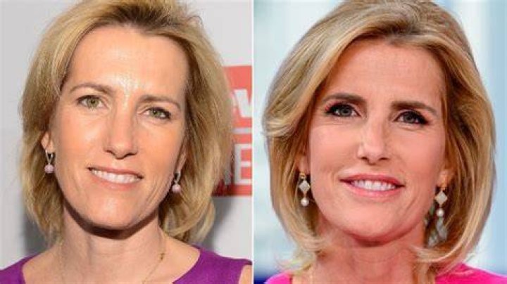Laura Ingraham Lips