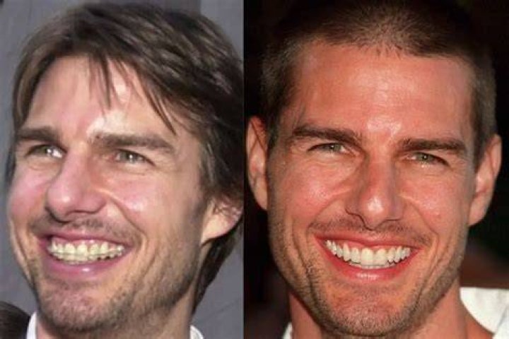 tom cruise teeth transformation