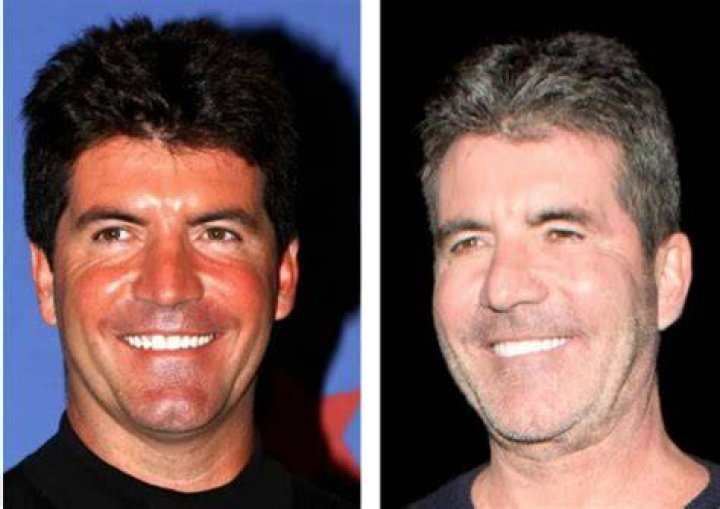 Understanding Simon Cowell's Son's Disability A Deep Dive