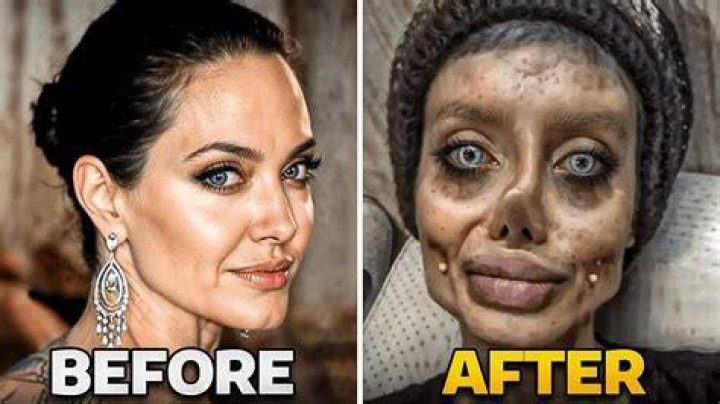 What Is Wrong With Yasmin Vossoughian Face